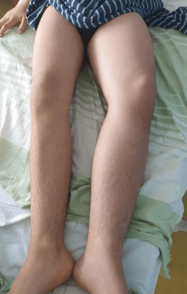 В одной из школ Киева избили 13-летнего мальчика, ему пришлось делать операцию1