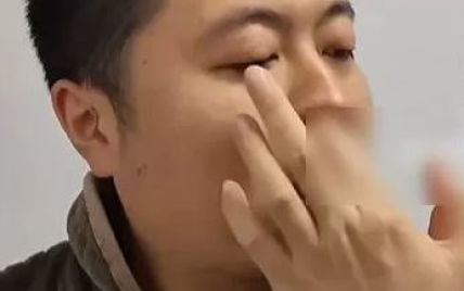 Любил ковыряться в носу и поплатился: мужчина перенес экстренную операцию (фото)